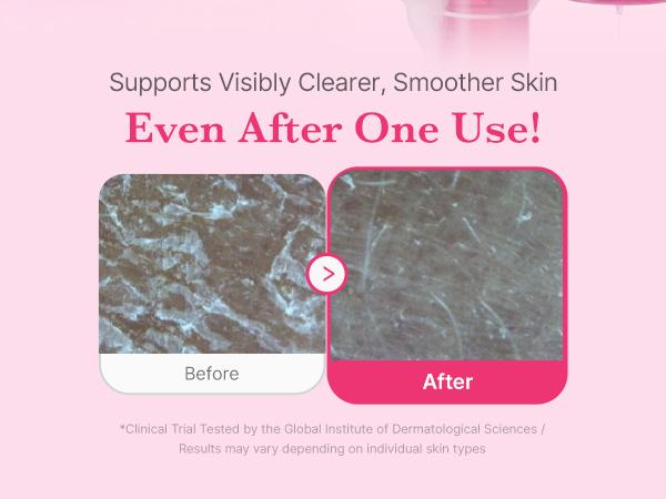 [medicube] PDRN Jelly to Foam Cleanser | Low pH Hydrating Daily Face Wash for All Skin Types | With PDRN, Collagen & LHA | Gentle Pore Care & Radiant, Balanced-Looking Skin | Korean Skincare | 200ml / 6.76 fl.oz