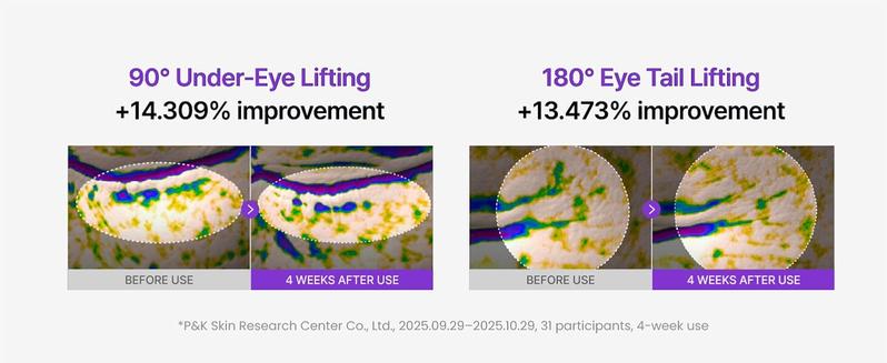 [Centellian24] 360° Shot PDRN Lifting Eye Cream | Firming & Anti-Aging Eye Treatment for Fine Lines & Dark Circles | TECA + PDRN + Retinol | Korean Skincare | 30 ml