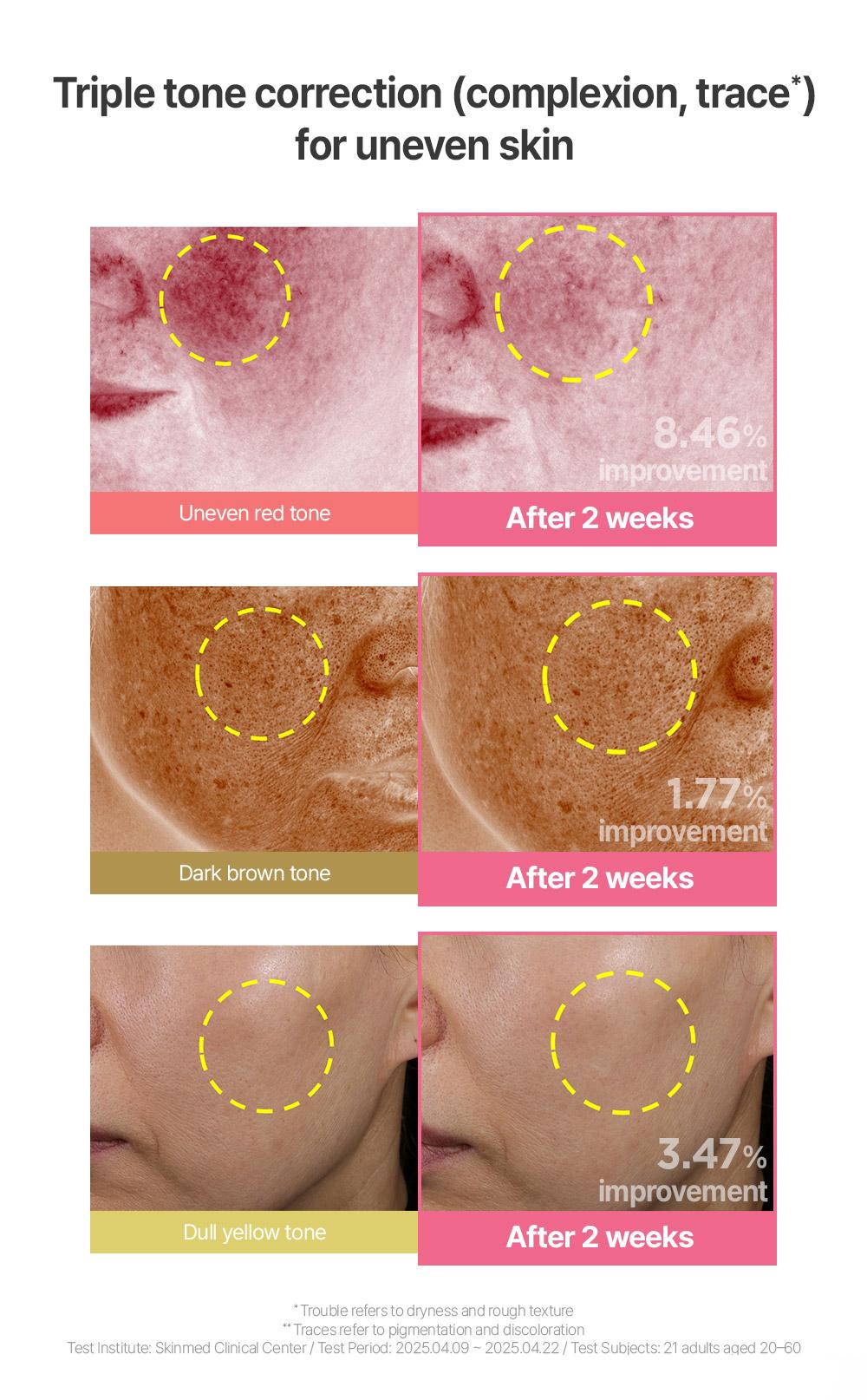 [BeginS by JUNGSAEMMOOL] Pink Guava Glutathione Blemish Serum - Korean Facial Serum with 10% Niacinamide, Vitamin C-rich Jeju Guava for Dark Spot Care, Radiant Glass Skin (1.01 Fl Oz)