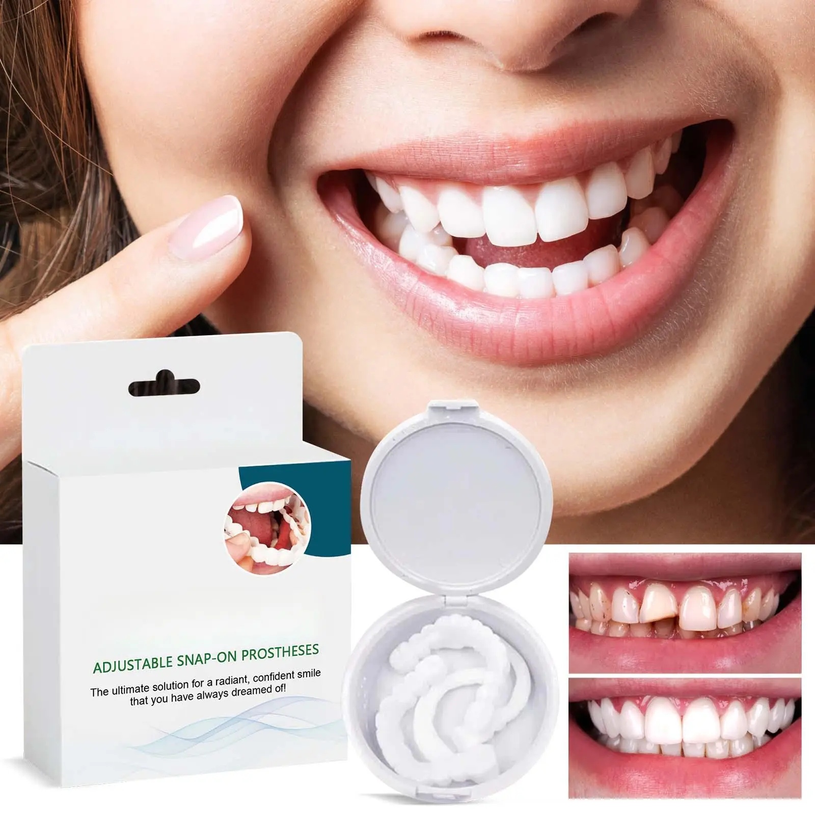 FashionAdjustable Snap-On Dentures - The Best Gift For Boys And Girls' Dental Th.A Denture Kit For Teeth Modification, Closing Tooth Gaps, Braces And Orthodontics.Dental Brace