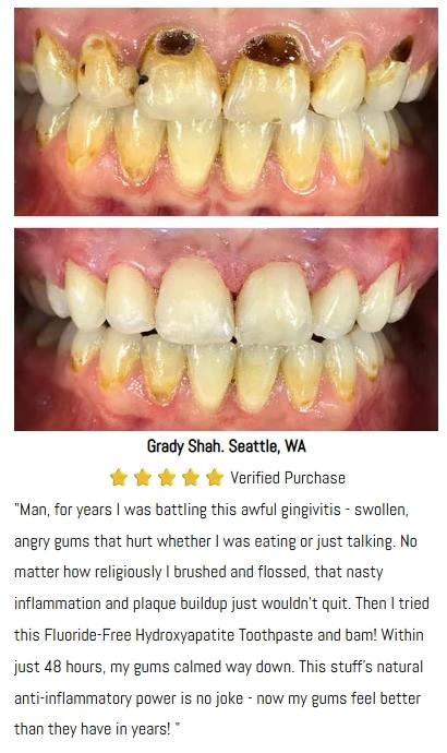 AstraGlow SP-8 toothpaste - Targets Stains for Removal, Whitens to Perfection, Battles Tooth Decay & Infuses Breath with Freshness Oral Whitening hydroxyapatitetoothpaste