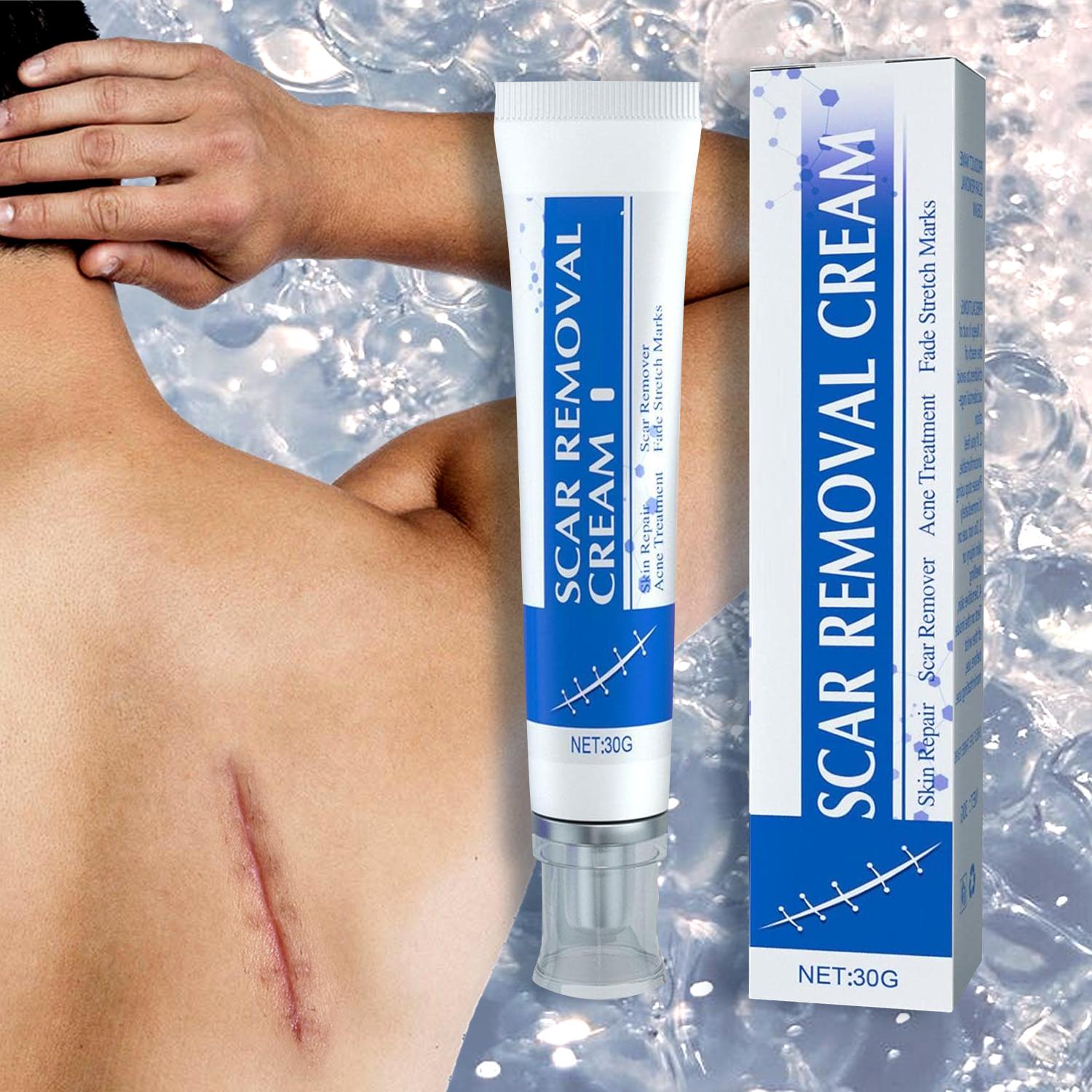 3 Repair Scar Smoothing Creams, Advanced Silicone Scar Removal Gel, Face & Body | Fades Dark Scars
