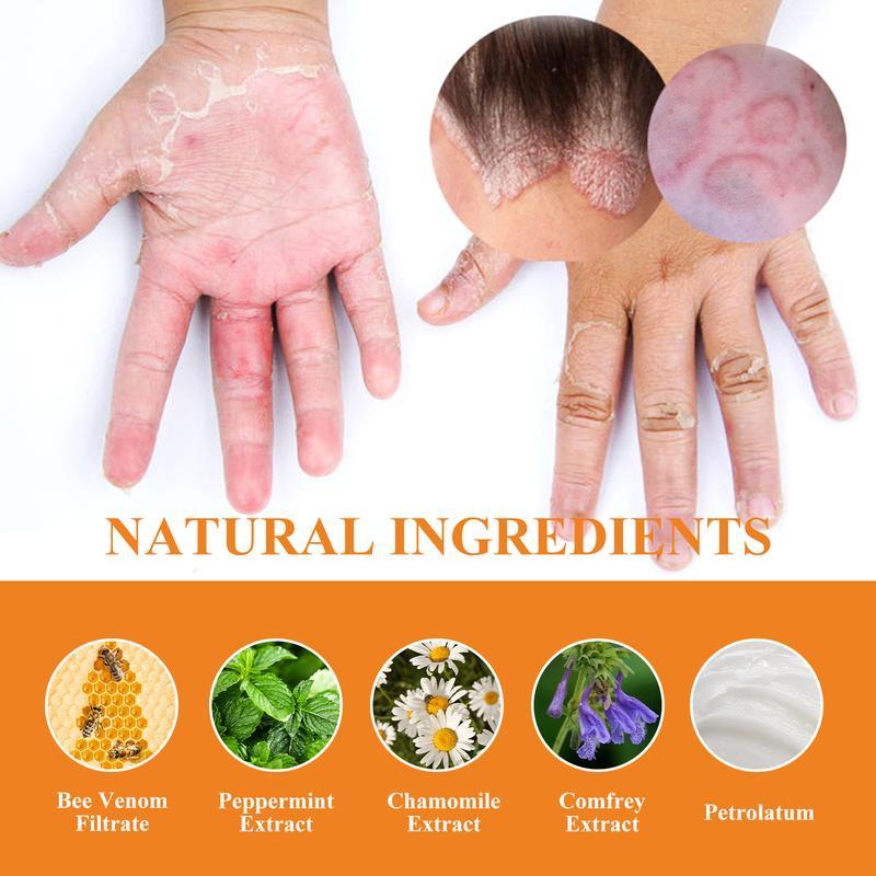 Herbal Antifungal Cream – Soothes Itching from Psoriasis, Eczema, Ringworm, Jock Itch, Athlete’s Foot, Toenail Fungus, Yeast Infection & Tinea – 100% Plant-Based, Steroid-Free – Restores Dry Cracked Skin & Protects Against Recurrence
