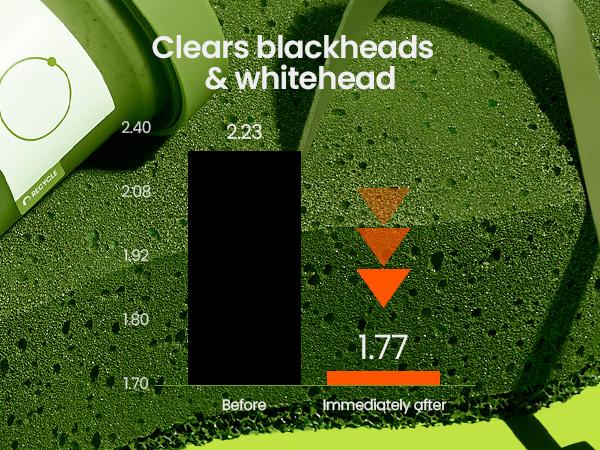 [beplain Official] Skin Detox Clay Mask for Filter Skin | Korea's No.1 Mung Bean Pore Clay Mask 120ml | Deep Pore Cleansing &Skin Repair & Gentle Exfoliation with Mung Bean Complex | Special Porecare