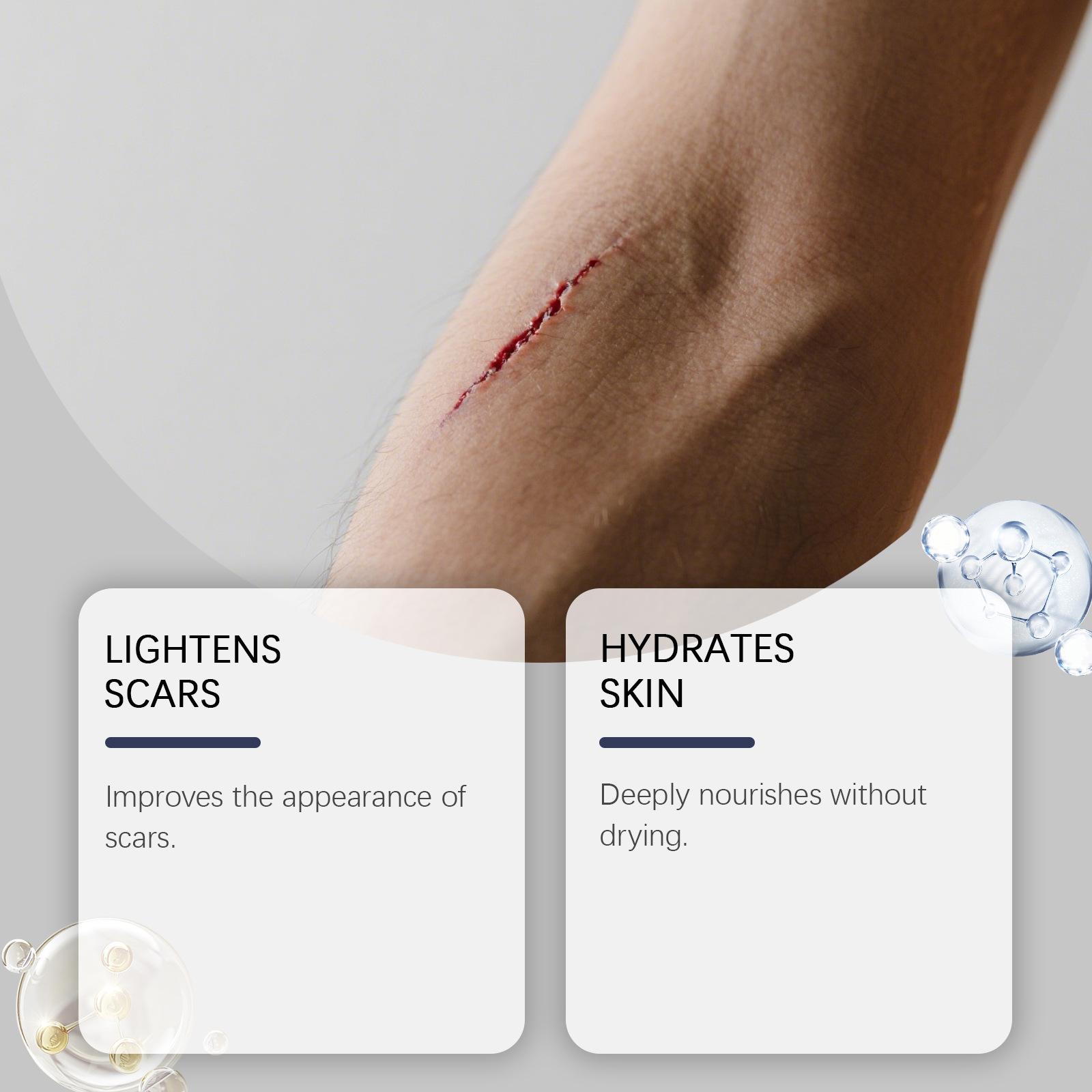 Scar Solutions Silicone Scar Stick for Face and Body 60% Soothing Moisturizing Gentle on All Skin Types Easy-to-Use Stick Design 6g