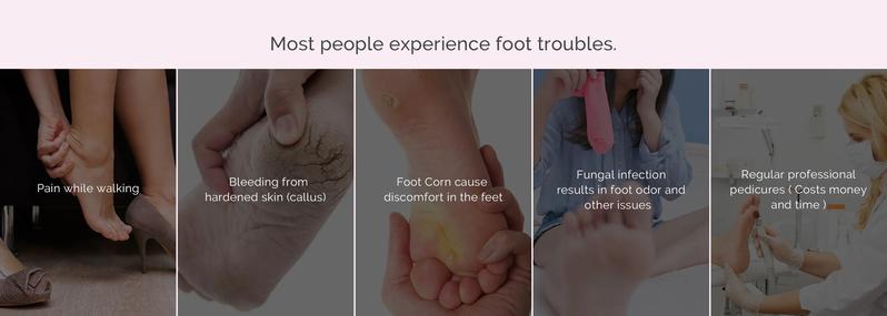 PC800G Rechargeable Feet Callus Remover, ginger nail treatment and portable foot care tool