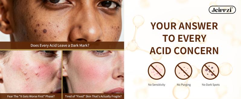 Jeirrzi Peeling Shot Glow Rice Exfoliant Ampoule, 5% Complext Acid Gentle Exfoliating Serum with Salicylic Acid, Brightening and Smoothing for Sensitive Skin