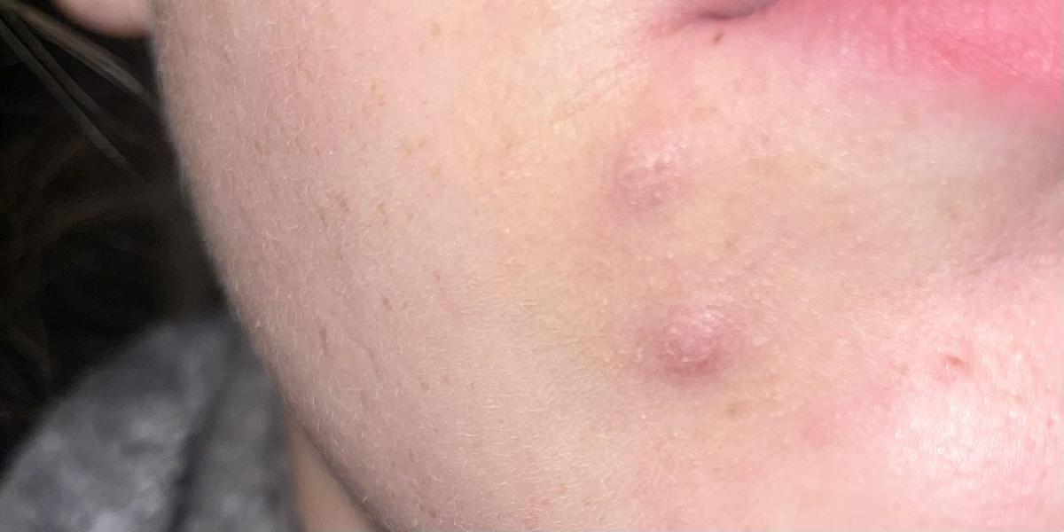 Item: 20B light (light skin with cool