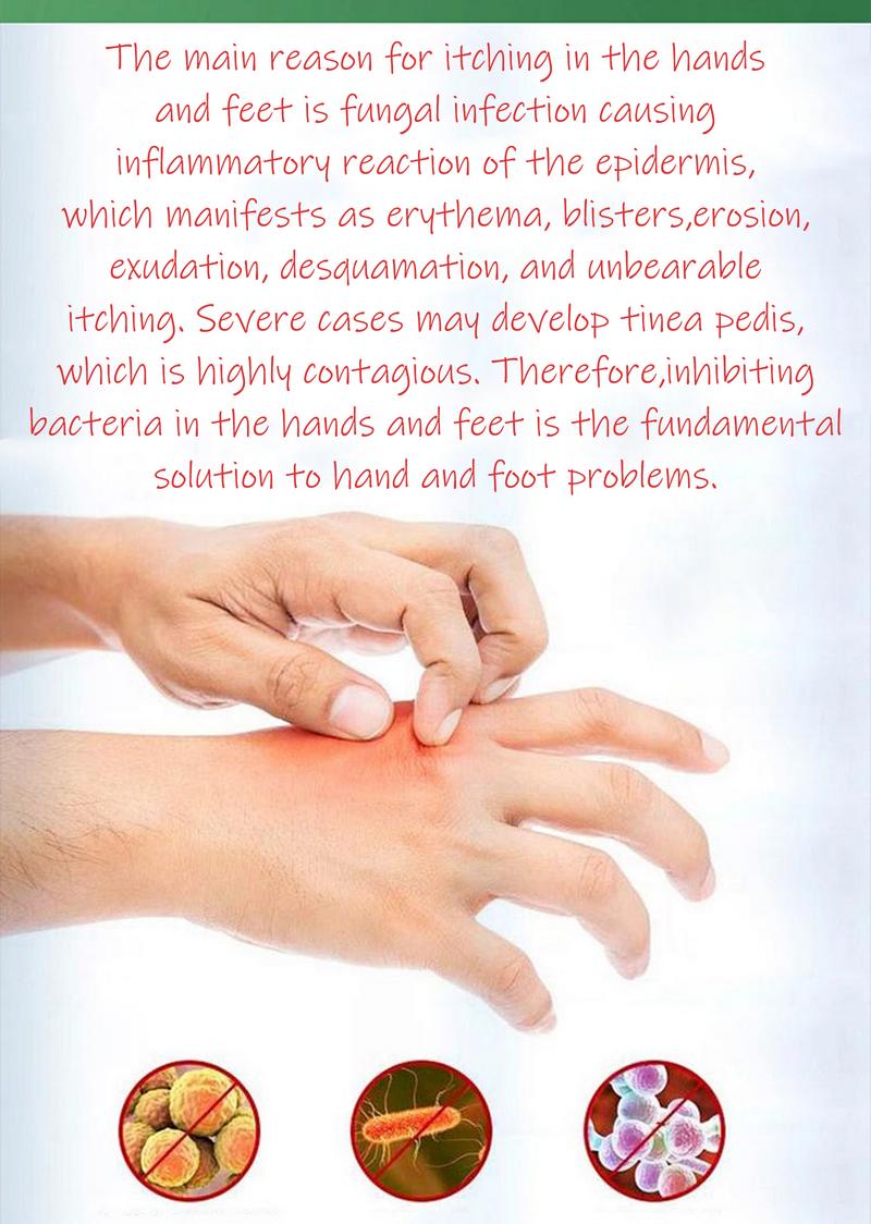 SanNuo Sensitive Skin Relief Cream– Fast Relief from Eczema, Blisters & Dry Itchy Skin with Oatmeal-Style Soothing, Zero-Irritant, Fragrance-Free – 30 g