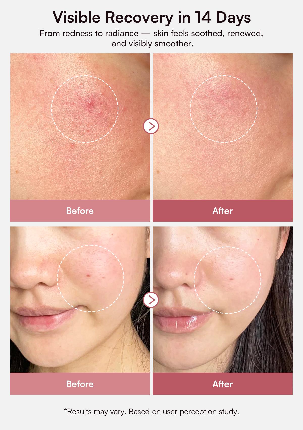 INIA PDRN + Peptide Repair Serum – Dual Repair, Brighten & Even Tone for All Skin Types, Including Sensitive Skin, with Salmon DNA, Peptides & Niacinamide, Layerable with Sunscreen & Makeup