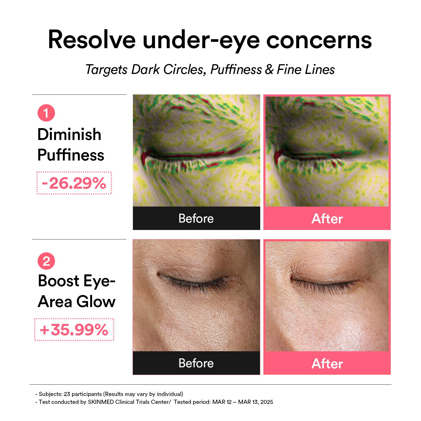 [Abib Official] PDRN Retinal & Collagen Eye Patch Duo | Korean Skincare, Firming, Hydrating, Brightening, Under Eye Care, Eye Mask (60 patches)