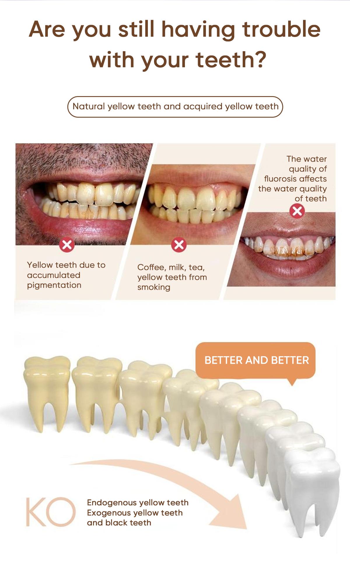 MySmile Ultimate Deluxe 10 Min Teeth Whitening Kit with 28 LED Light, 35% Carbamide Peroxide Teeth Whitening Gel TikTokShopdealsforyoudays TikTok Shop Deal