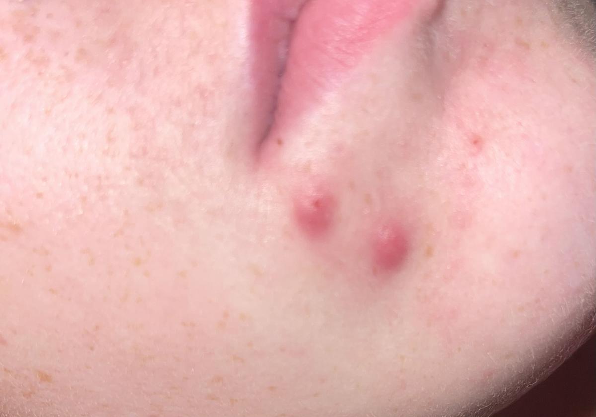 Item: 20B light (light skin with cool