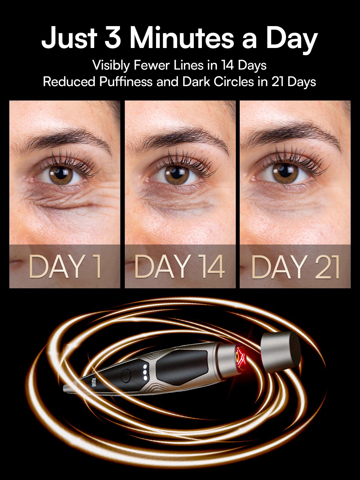 INIA LUMIN 4-in-1 Eye Skincare Wand – 3 Mins a Day for Fewer Lines in 14 Days & Less Puffiness in 21, FDA-Cleared, Spa-Level Results at a Fraction of the Price, Lift & Brighten Eyes in Just Weeks