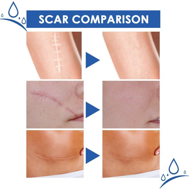 JAYSUNG Professional Scar Removal Cream Advanced Silicone Skin Repair Gel for Burn Acne Old Scar Removal Cream for Face & Body Fades Dark Scars 30g