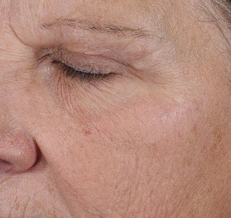 Obagi Medical ELASTIderm Lift & Sculpt Facial Moisturizer – lifts, firms, and hydrates with Bi-Mineral Complex