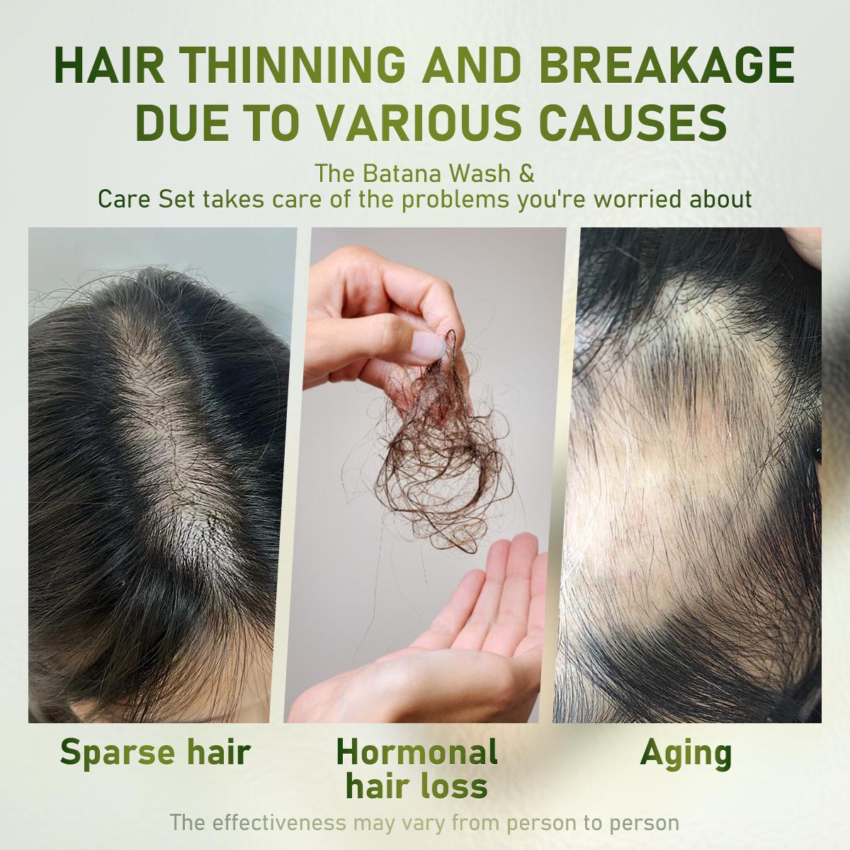 Gypsophila Batana Oil Hair Care Set - Shampoo & Conditioner Duo with Rosemary Extract for All Hair Types Repair Hydrate Smooth Daily Haircare Gentle 300ml Each Moisture Moisturizing Gypsophila Batana Oil Hair Care Set - Shampoo & Conditioner Duo with Rosemary Extract for All Hair Types Repair Hydrate Smooth Daily Haircare Gentle 300ml Each Moisture Moisturizing