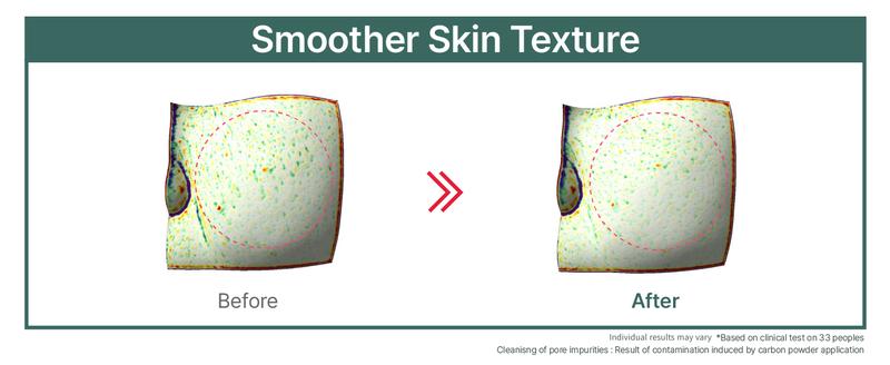 ILLIYOON Gentle Foaming Deep Facial Cleanser | Hypoallergenic & Sensitive Skin-Friendly, Cleanser for Dry and Acne-Prone Skin, Oil Control, Vegan-Certified, 8.45 fl. oz. (250ml)