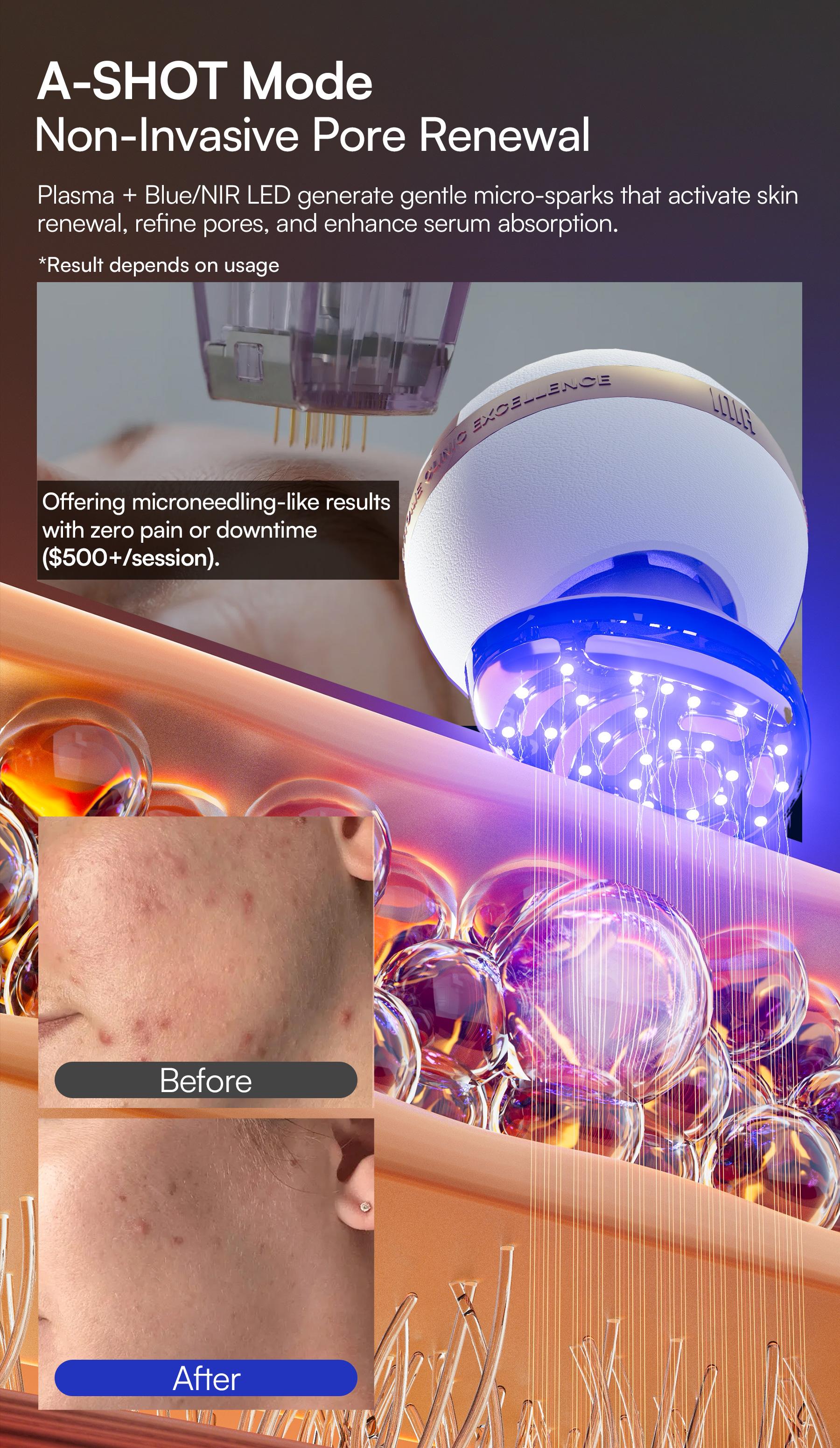 INIA SPHERA At-Home RF & LED Anti-Aging Facial Device – Lift, Tighten & Sculpt with EMS Microcurrent, Red Light Therapy, Electroporation & Cryo Cooling for Firm, Glowing Skin, Best Valentine's Day Gift for Her