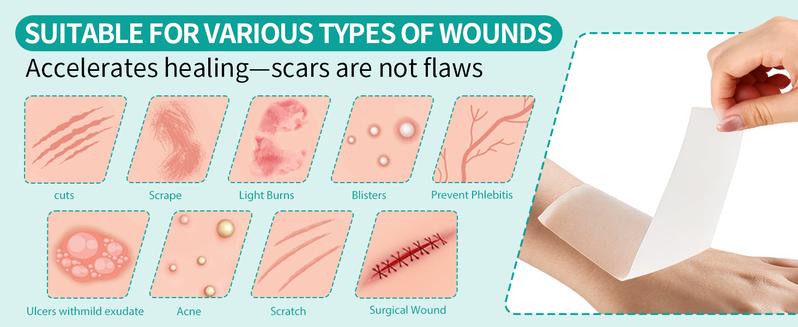 Amzfusfred Medical-Grade Hydrocolloid Bandage Roll Waterproof Flexible Hypoallergenic Latex-Free for Wound Care Secure Adhesion Semi-Transparent Comfortable Design Healthcare Aid