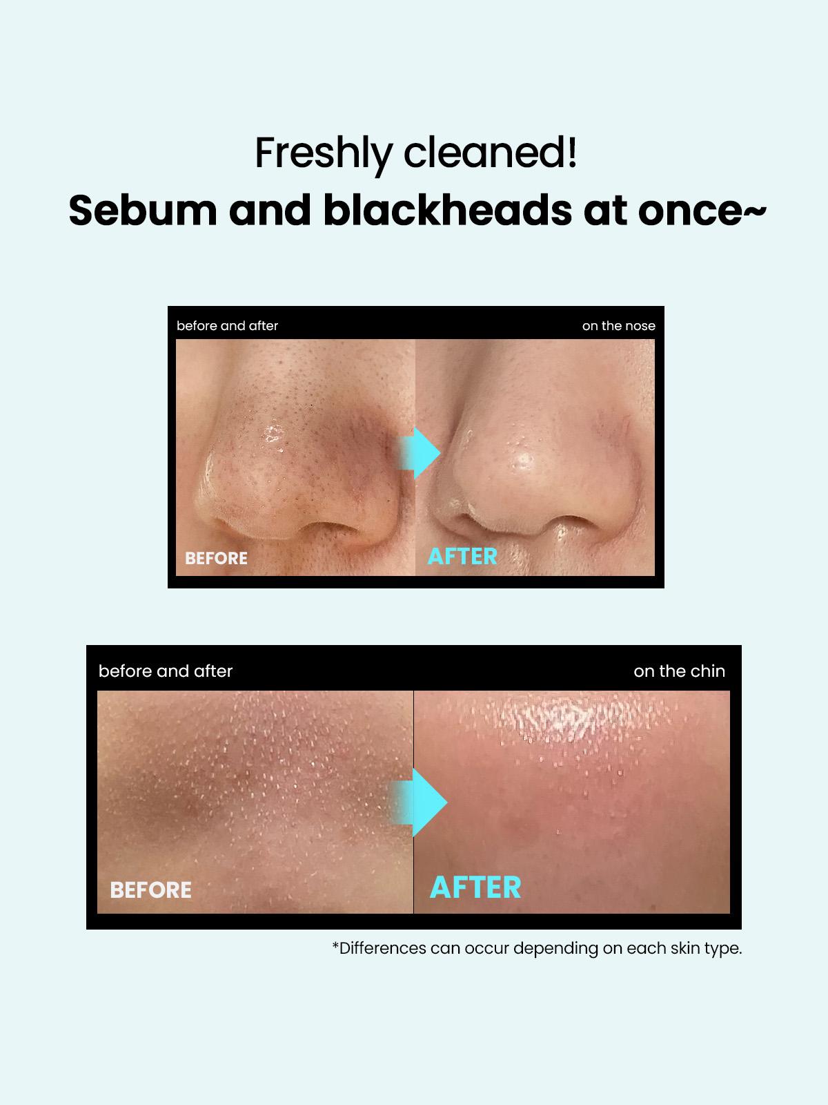 ILSO Super Melting Sebum Softener 5.29 fl oz with 40 Skin Wrap Cotton Pads Included for Deep Clean Master Makeup Remover Towelettes Facial Cleansing Wipes Daily,Melt Blackheads and Sebum