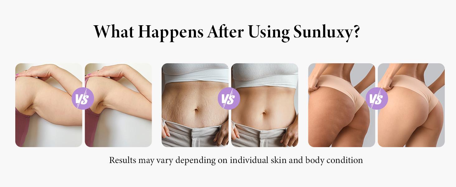 SunLuxy 3-in-1 Red Light Therapy & Cupping Suction Machine for Relaxation, Skin Rejuvenation, and Facial Firming – Perfect Valentine’s Day Gift – 3 Power Levels, Ergonomic Design, Type-C Charging