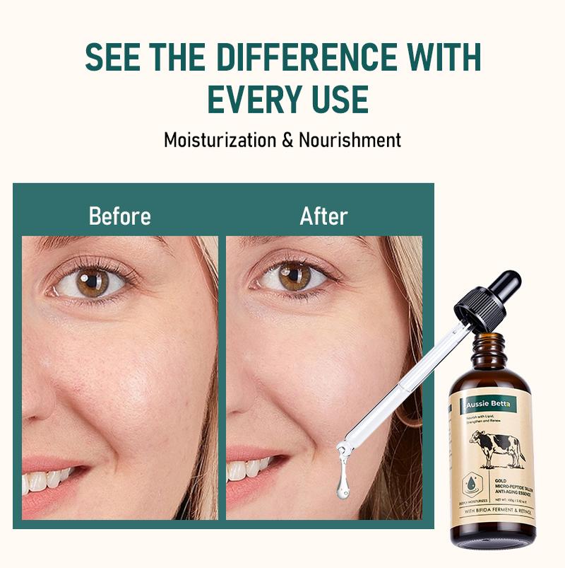 Aussie Betta Australian Pure Beef Tallow Golden Micro Peptide Serum with Niacinamide and Bifida Skin Repair Formula for Fine Lines and Dark Spots No Irritation Visible Results Anti Aging Firming Deep Hydratio