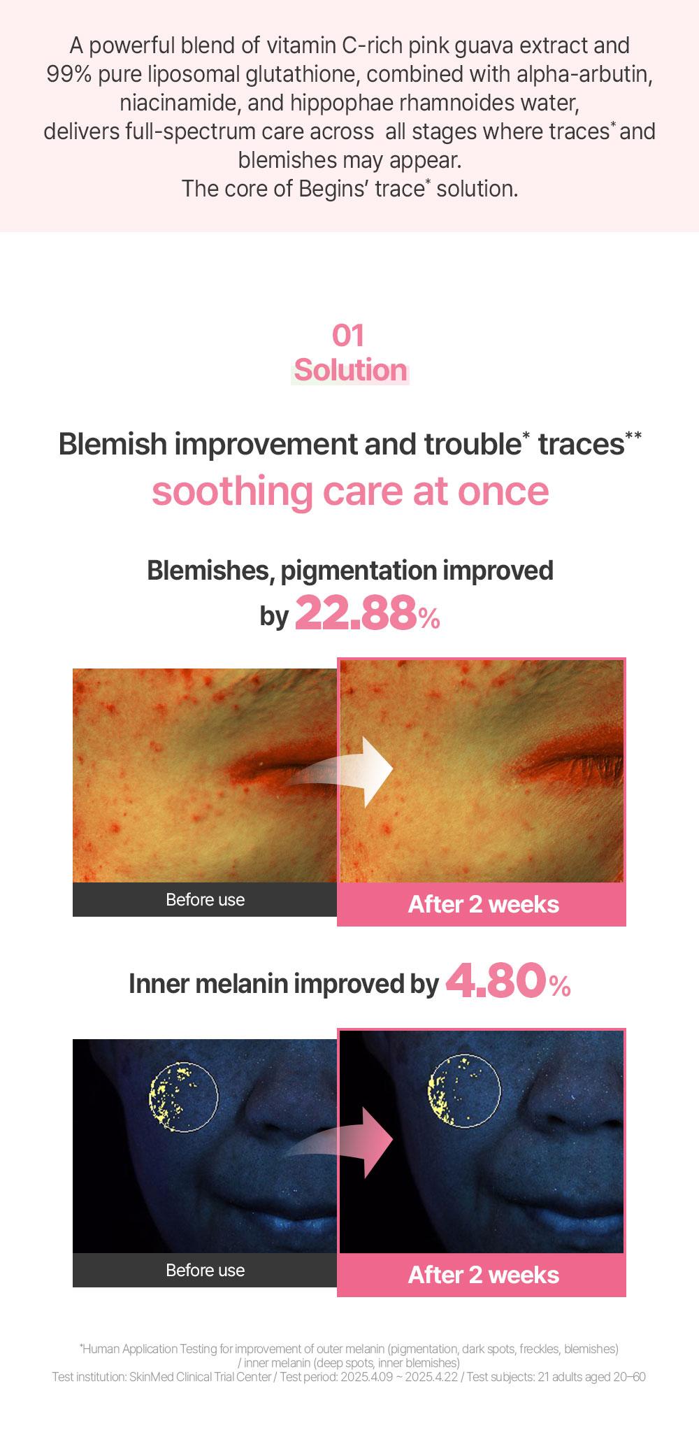 [BeginS by JUNGSAEMMOOL] Pink Guava Glutathione Blemish Cream | Korean Face Moisturizer | Glutathione Capsules, Niacinamide, Jeju Guava for Dark Spot Care and Radiant Glass Skin (1.7 Fl Oz)