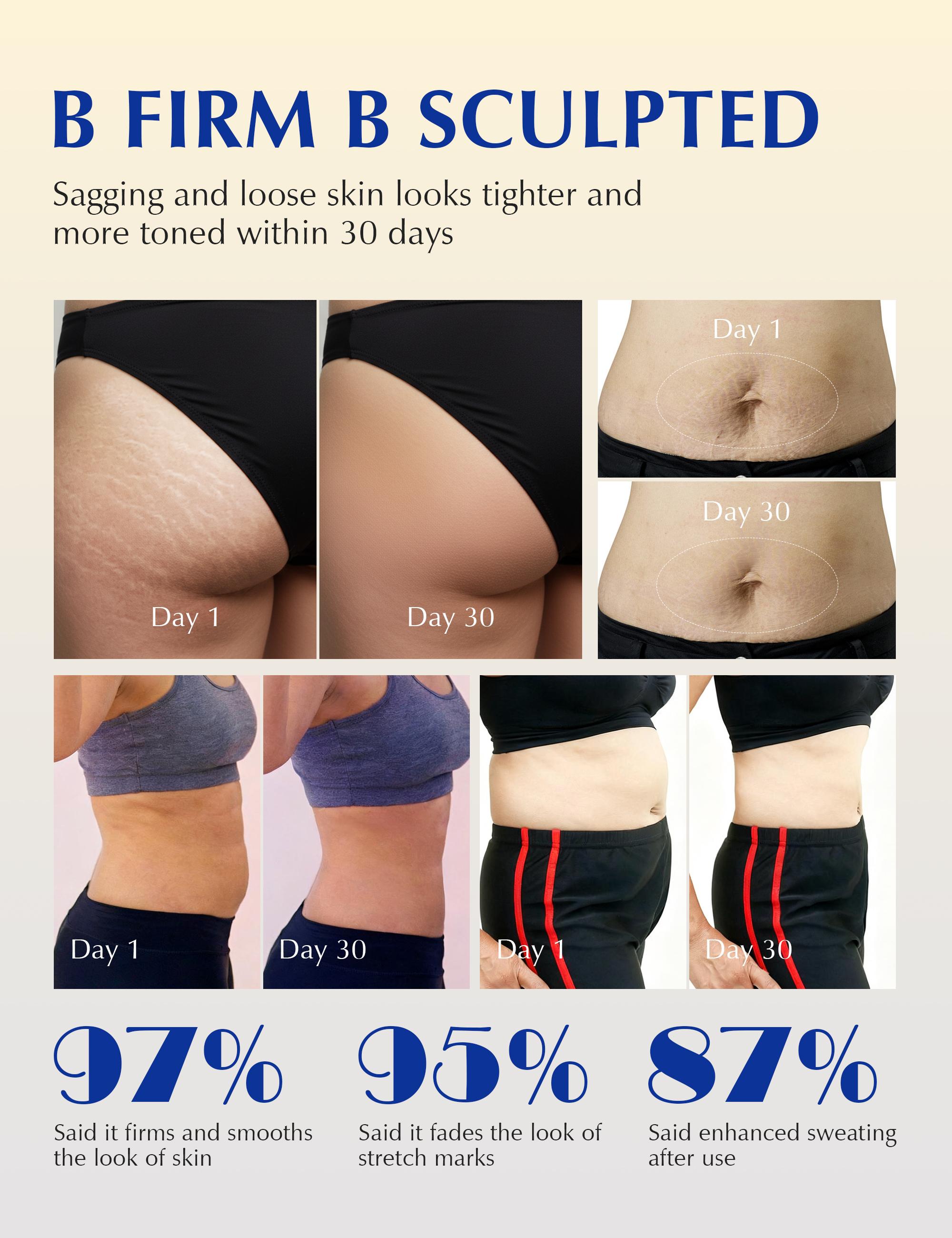 15-Day Fast-Acting Anti Cellulite Sculpting & Tightening Burn Gold Massage Cream | Cryo Thermo Firming Gold Gel for Belly Thigh Butt & Arm Firming Toning Moisturizing Sculpting & Smoothing|Unisex Body Contouring Treatment for Men & Women |200 G 15-Day Fast-Acting Anti Cellulite Sculpting & Tightening Burn Gold Massage Cream | Cryo Thermo Firming Gold Gel for Belly Thigh Butt & Arm Firming Toning Moisturizing Sculpting & Smoothing|Unisex Body Contouring Treatment for Men & Women |200 G
