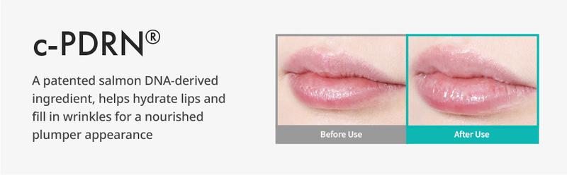 REJURAN Calming Lip Balm, c-PDRN – Deep Moisturizing & Soothing Care for Dry, Chapped Lips with Shea Butter & Jojoba Ester, Non-Sticky Formula & Fragrance-Free, Korean Skincare (3.7g)