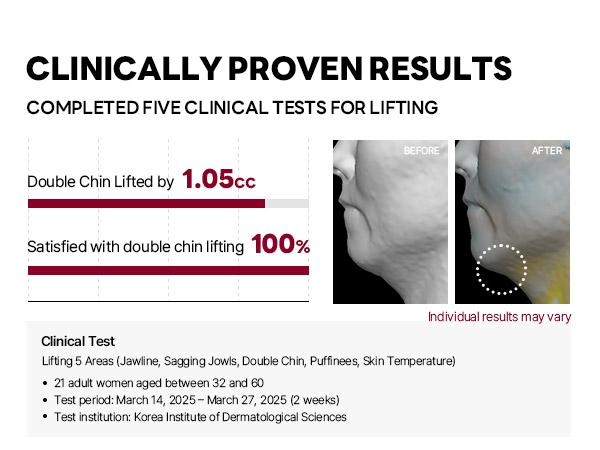 [Viral] Camellia Deep Collagen Chin Lifting Gel Mask – Zempic Neck Solution, Double Chin Reducer, Defined Jawline Shaper,  Firming, Jeju Camellia Ingredients for Skin Repair