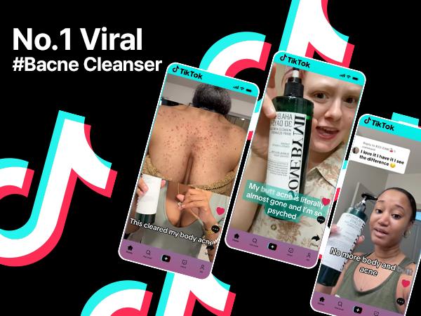 AHA BHA PHA 30 Days Miracle Acne Clear Body Cleanser 13.5oz - Body Odor Control & Back Acne Treatment - Gentle Exfoliating Body Wash - Korean Skincare