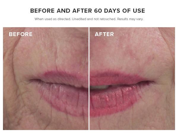 DRMTLGY Needle-less Serum 1oz with Peptides and Hyaluronic Acid Gentle Skincare