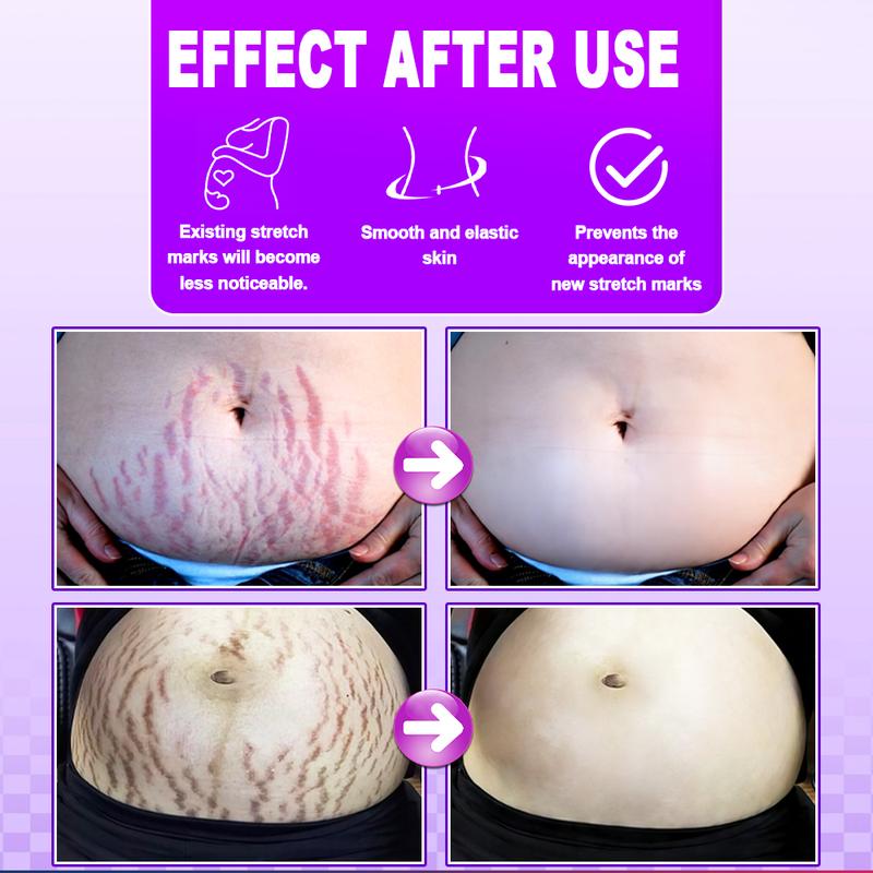 Stretch Mark Repair Serum: Fades stretch marks, moisturizes the skin, and improves skin elasticity. Apply to affected areas to revitalize the skin and prevent the formation of new stretch marks. Stretch Mark Repair Serum: Fades stretch marks, moisturizes the skin, and improves skin elasticity. Apply to affected areas to revitalize the skin and prevent the formation of new stretch marks.