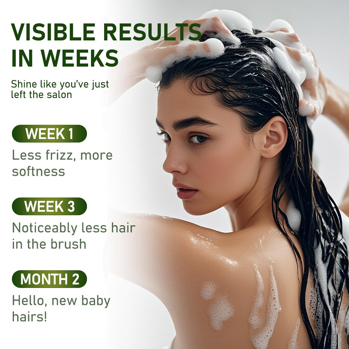 Gypsophila Batana Oil Hair Care Set - Shampoo & Conditioner Duo with Rosemary Extract for All Hair Types Repair Hydrate Smooth Daily Haircare Gentle 300ml Each Moisture Moisturizing Gypsophila Batana Oil Hair Care Set - Shampoo & Conditioner Duo with Rosemary Extract for All Hair Types Repair Hydrate Smooth Daily Haircare Gentle 300ml Each Moisture Moisturizing