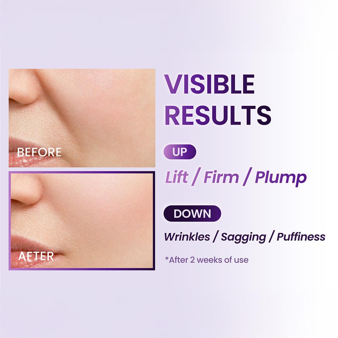 BIOHEAL BOH Probioderm 3D Lifting Travel Size Skin Care Kit | Korean Skincare Set for Firming & Hydration, with Ampoule, Face Moisturizer & Serum Spray | Mini Travel Essentials & Gift Set for Women Smooth Restore BIOHEAL BOH Probioderm 3D Lifting Travel Size Skin Care Kit | Korean Skincare Set for Firming & Hydration, with Ampoule, Face Moisturizer & Serum Spray | Mini Travel Essentials & Gift Set for Women Smooth Restore