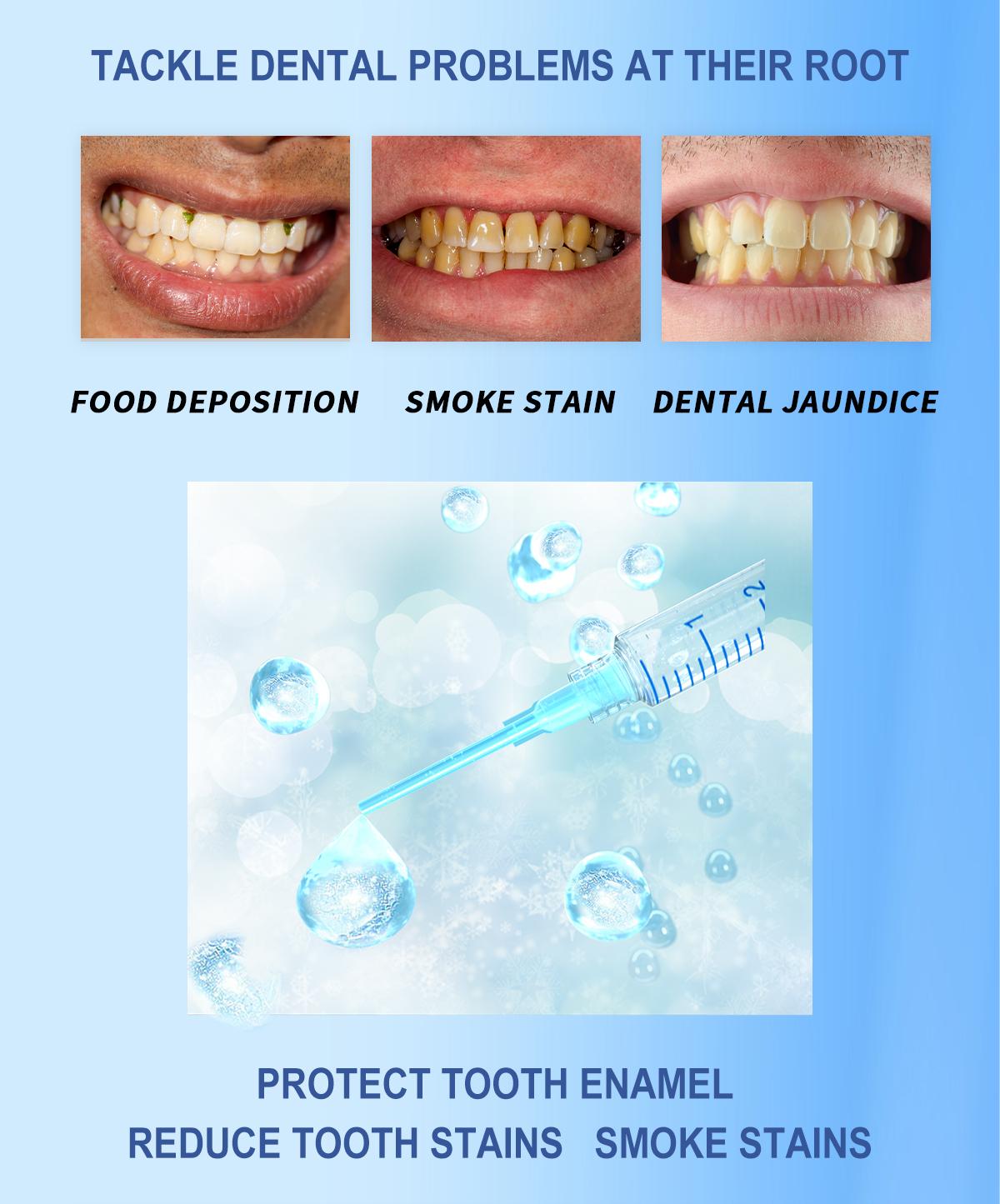 MySmile Original Teeth Whitening Kit with LED Light (5x Bulbs) - 3 Gels for Sensitive Teeth | Fast 10-Min Results