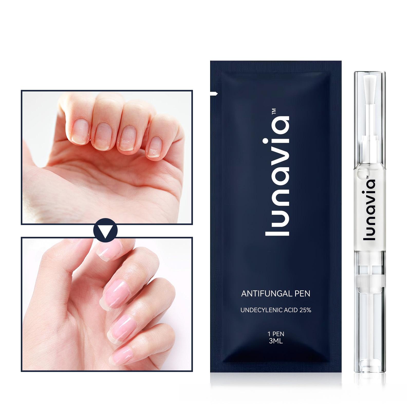 Lunavia Antifungal Pen UNDECYLENIC ACID 25% for Athlete's Foot Jock Itch & Ringworm Treatment 3ML