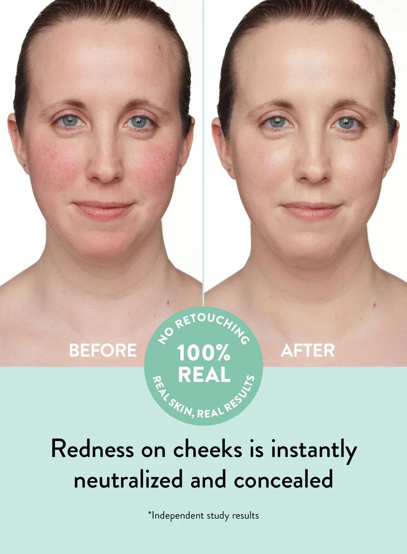 Peach Slices Redness Relief Duo: Your Glow-Up Essentials