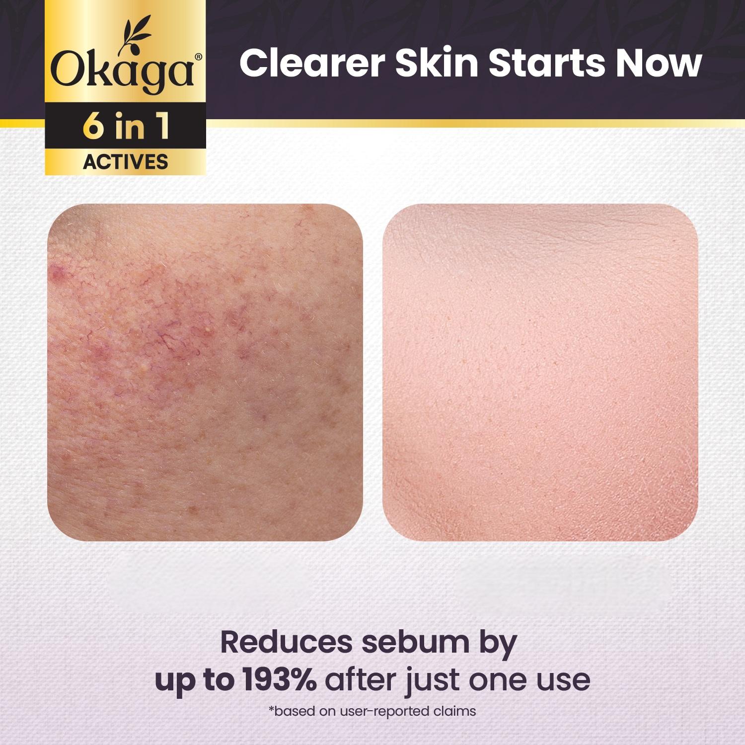 Okaga Natural Black Rice Peel Shot Ampoule - 100% Organic Serums for Brightening, Exfoliating, and Moisturizing - Suitable for All Skin Types