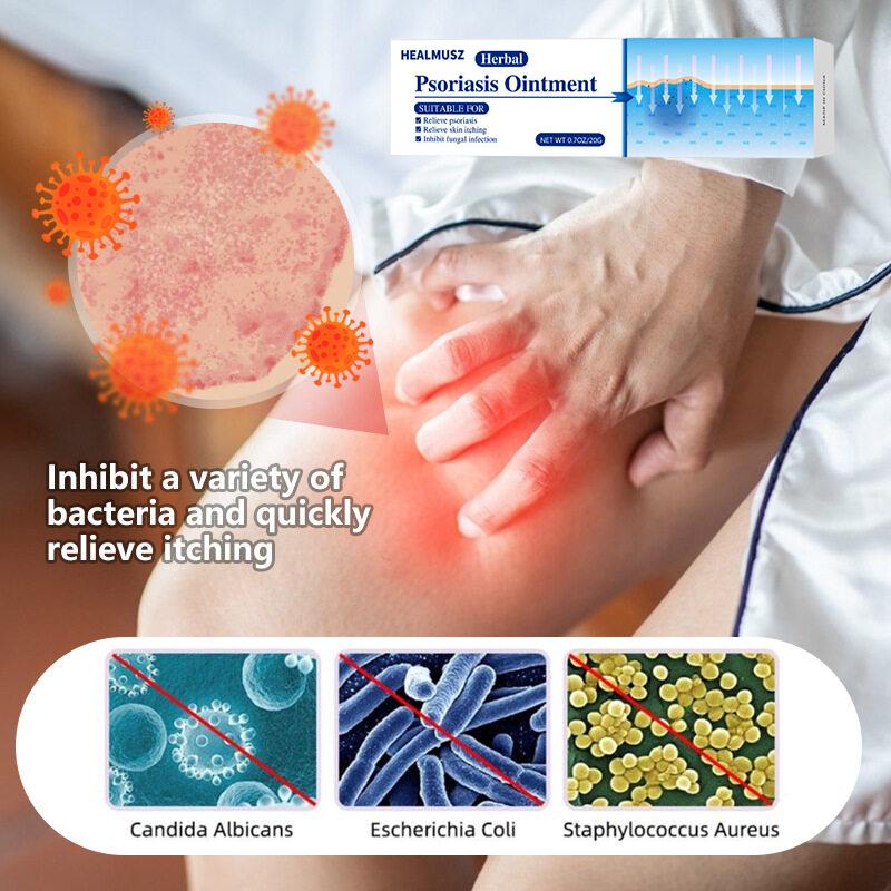 Powerful Antifungal Cream—Results in 7 Days—Effective for Psoriasis, Eczema, Ringworm, Jock Itch, Athlete's Foot, Onychomycosis, and Herpes—100% Natural Botanical Formula—Rapid Itch Relief, Prevents Recurrence, Repairs Dry, Cracked Skin Body Care Cream