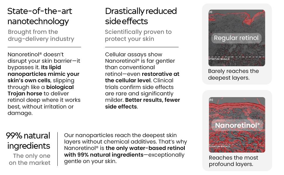 NANORETINOL, the 232% more Effective Retinol Serum for Face, Eye Contour & Neck - Clinically Proven - Encapsulated Nano Retinol in Biomimetic Nanoparticles - Anti-Aging & Dark Spot Remover, Skincare Repair Cream for Night