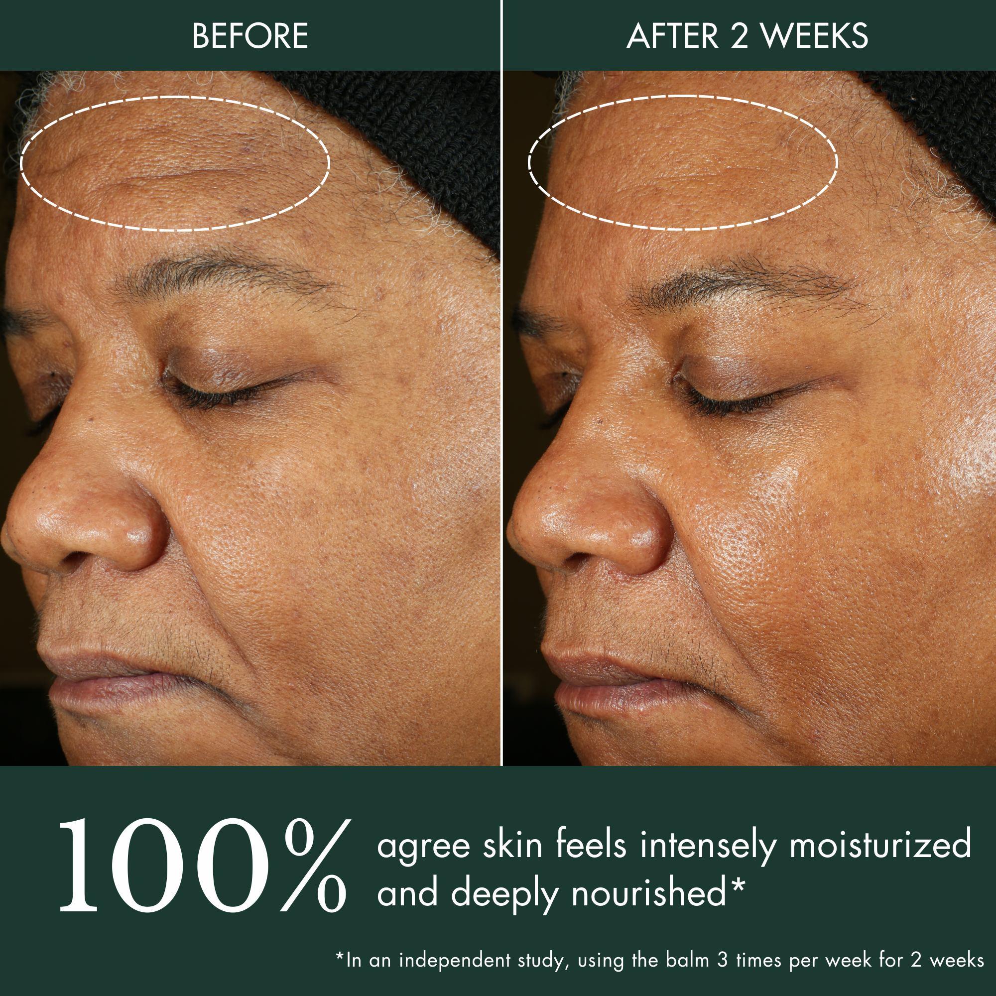 【Spring Glow Up】RéVive Rescue Balm Overnight Face Mask - Nourishing Facial Mask to Help Visibly Improve Signs of Stress & Restore Skin Vitality - Made with Peptides, Shea Butter & Aloe Vera to Soothe Skin (2.5 oz)