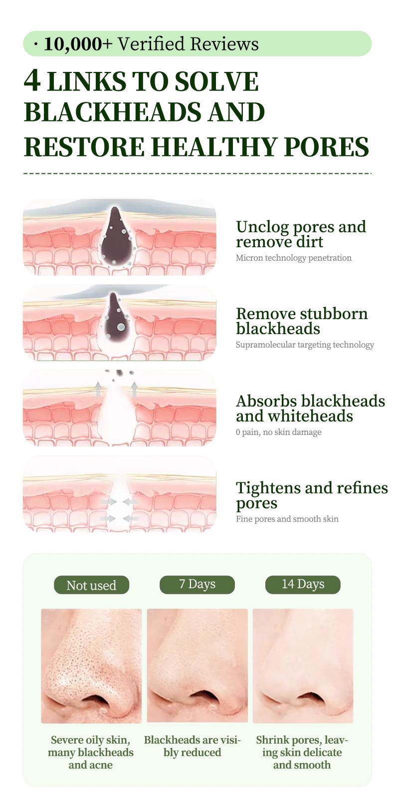 Cubidupi Triple Acid Double Herb Bubble Clay Mask - 3 Acids (Salicylic Acid + Lactobionic Acid + Mandelic Acid) & 2 Herbs (Centella Asiatica + Asiaticoside) Deep Cleansing, Oil Control & Pore Soothing | Bubble Clay Wash-Off Mask | 5g x 20 packs