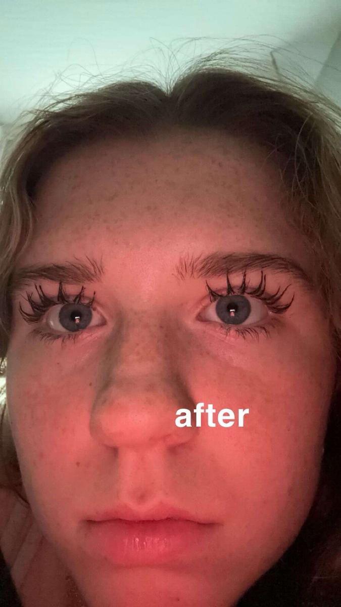 Item: 3 Month Supply (2 mL)