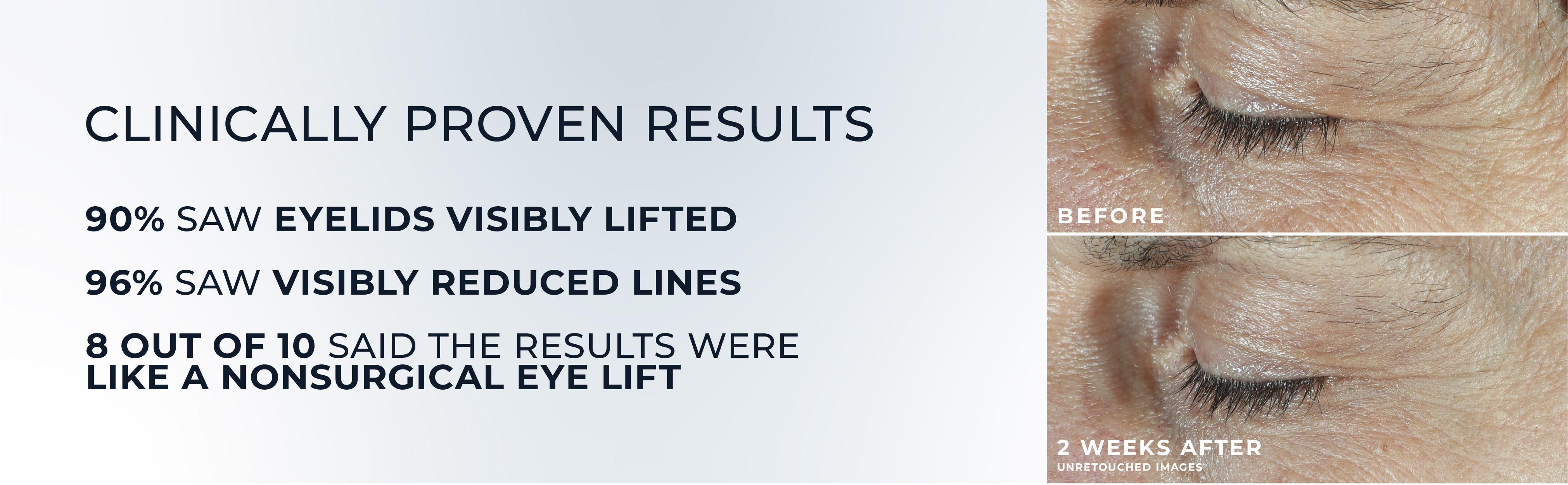 [RoC Skincare] DERM CORREXION Dual Eye Cream