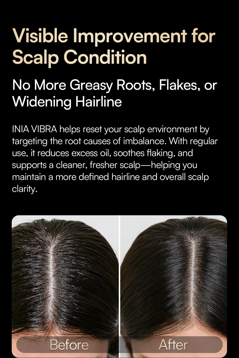 【LIVE EXCLUSIVE】INIA VIBRA 4-in-1 Scalp Therapy Device, Red Light, Microcurrent, Massage, Serum Infusion, Scalp Massager Beauty Device, Waterproof & Wet/Dry Use, Perfect Holiday Gift