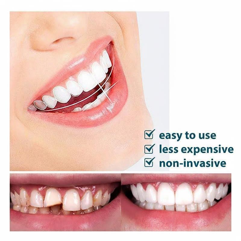 【3 Pairs】Snap On Veneers for Men & Women  Instant Whitening Smile Kit - Natural Look Reusable False Teeth Cover for Party & Daily