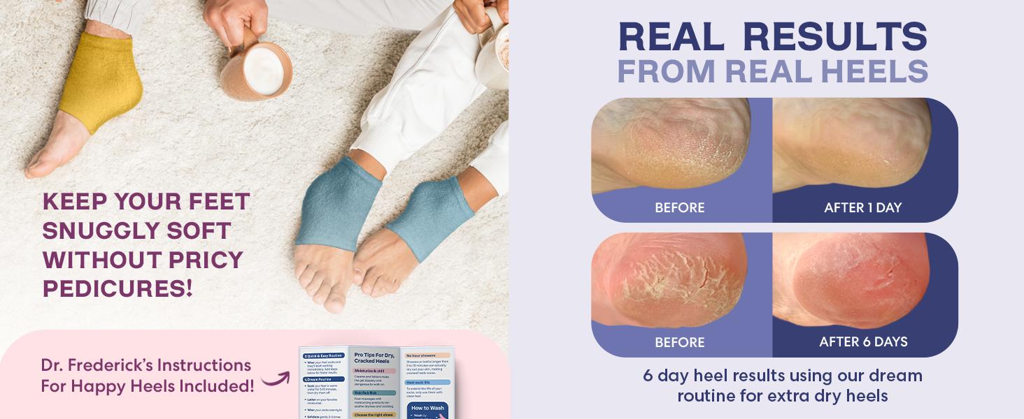 Pink - Foot Reset Duo - Relaxing Rose - Full Foot Gel Socks + Fuzzy Moisturizing Heel Socks - Cracked, Dry Foot Care