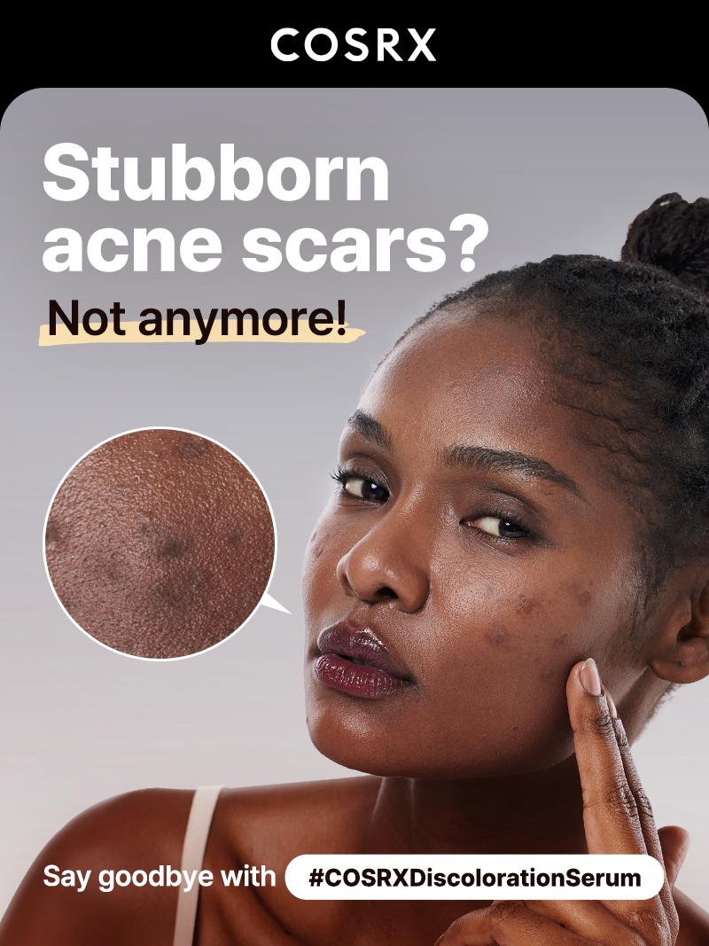 [COSRX Official] The Alpha Arbutin Discoloration Care 2 Serum (50ml) | MILD BUT HIGH-CONCENTRATION SERUM FOR HYPERPIGMENTATION & SCARS